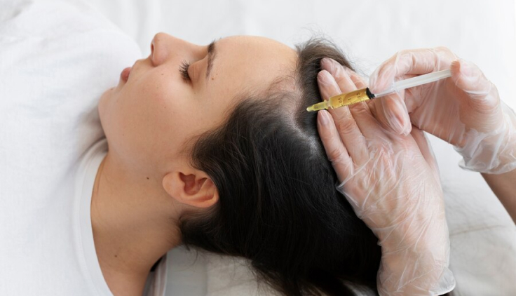 Profesional aplicando la terapia capilar de nutrientes