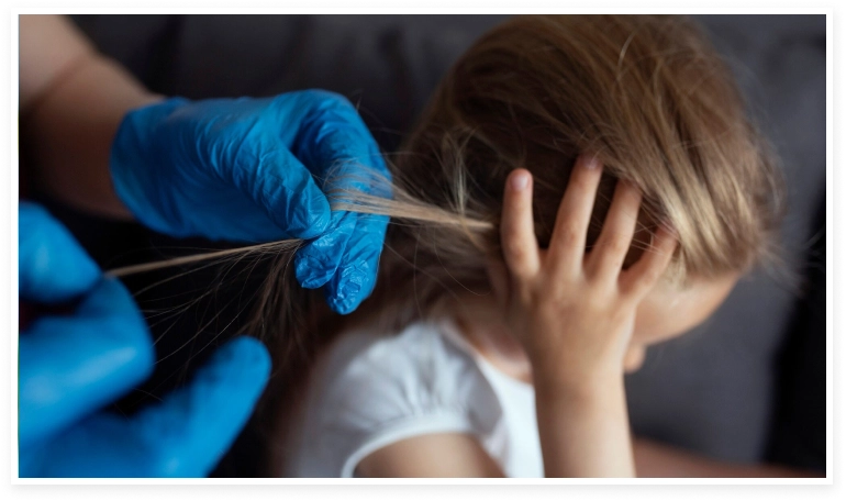 Persona revisando si la niña tiene piojos