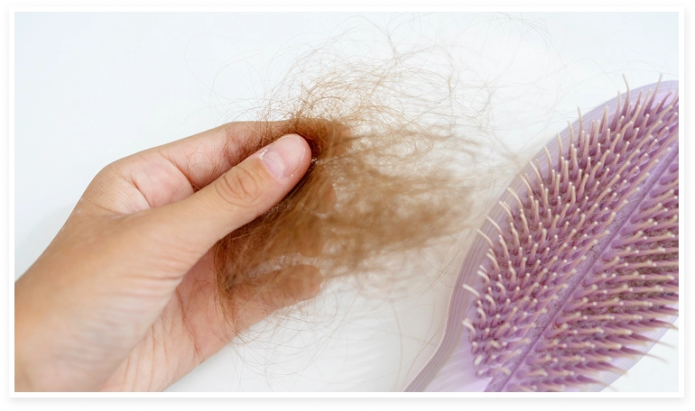 caída de cabello por efluvio telógeno